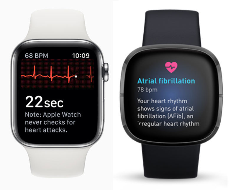 Aplicación de ECG Apple Watch y Fitbit